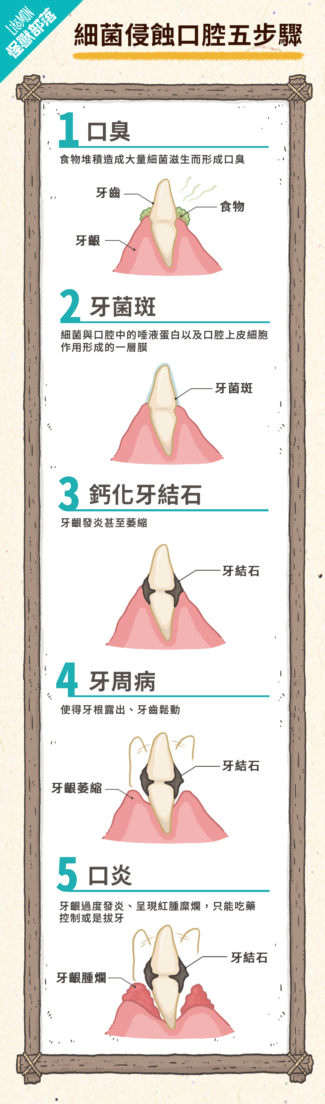 細菌入侵口腔五步驟